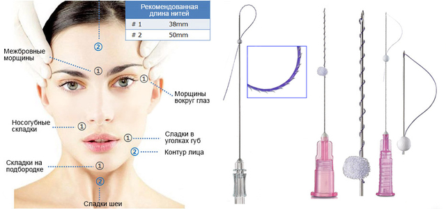 Мезонити Мезонити