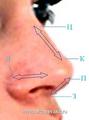 Хирургическая анатомия наружного носа (общая характеристика).
